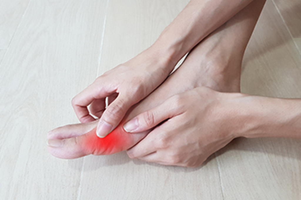 Podiatric Care for Painful Gout Attacks