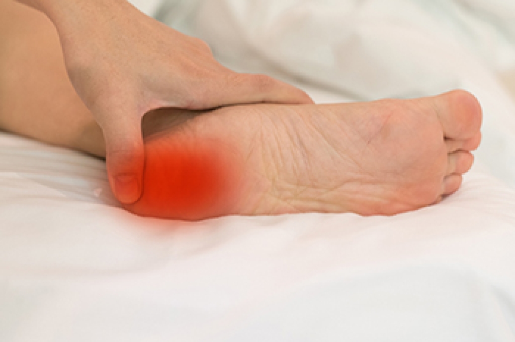 Common Causes of Heel Pain